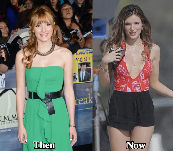 Bella Thorne and Breast Implants.